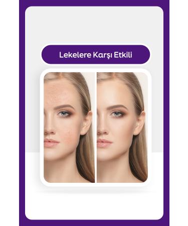 Dream Derm Niacinamide Blemish Cream - Tone Equalizer for Acne Sun Laser and Postpartum Blemishes 50 ml - Buy Online on GoSupps.com