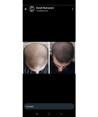 NUH Blonde Hair Solution - Buy Online on GoSupps.com