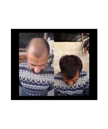 NUH Blonde hair solution - Buy Online on GoSupps.com