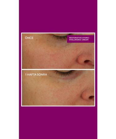 Murad Restorative Hydro-hyaluronic cream - Intensive Repair Ultra Powerful Moisturizer 50ml - Buy Online on GoSupps.com