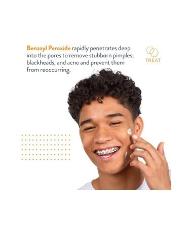 Terminator Terminator 10 Severe Acne Cream 30 Ml. - Buy Online on GoSupps.com