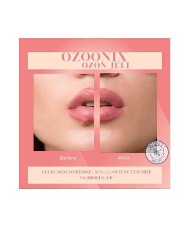 DNL Ozoonix Pure Ozone Gel Damaged Skin Blemish Cream Whitening - Buy Online on GoSupps.com