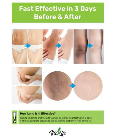 Illa Life Fast Effective Anti-Darkening Skin Whitening Underarm Private Area Bikini Area Whitening Cream - Buy Online on GoSupps.com