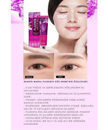 BRANIG Placenta Cream for Eye Contour and Face and Pore Tightening Made In Korea - Buy Online on GoSupps.com