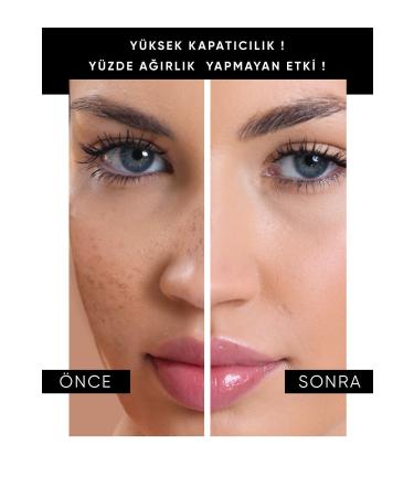 Melberry Infinity Foundation Large Size 40 ml Foundation Soft Medium - Buy Online on GoSupps.com