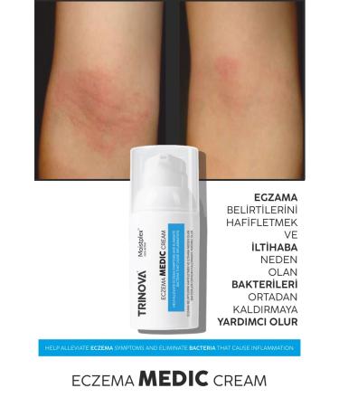 Trinova Eczema cream