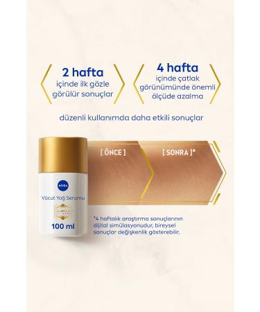NIVEA Luminous630 Anti-Blemish Day Face Cream 40ml Luminous630 Anti-Stretch Body Oil Serum 100ml - Buy Online on GoSupps.com