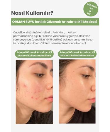 JOLAPOL Pore Purifying Clay Mask 50ml - Msk01 - Forest Water Extract High Effective - Buy Online on GoSupps.com