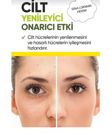 SINA LOKMAN HEKIM St. John's Wort Extract Cream 250 Ml. Effective and Definitive Solution with Brand New Special Ibn-i Sina Formula - Buy Online on GoSupps.com