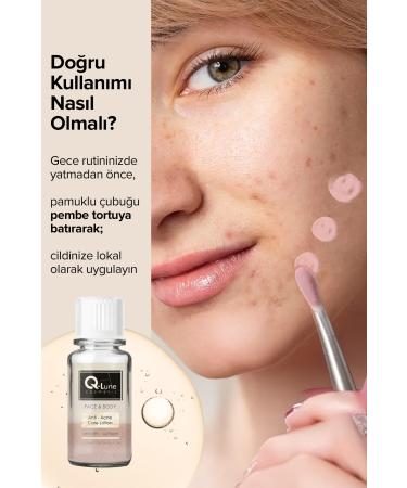 Q Lune Acne Drying Lotion / Pore Tightening Lotion 30 Ml (ANTI ACNE CARE LOSION) - Buy Online on GoSupps.com