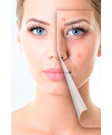 Orginx Anti-Acne and Anti-Acne Acne Blackhead Remover Cream 50 ml - Buy Online on GoSupps.com