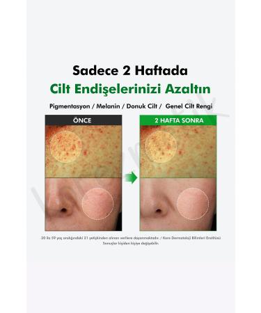 Dr. Althea Gentle Vitamin C Serum - Anti-Stain - 30ml - Buy Online on GoSupps.com