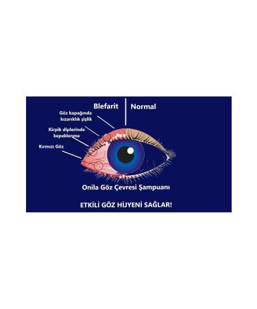 Onila Eye Contour Care Shampoo 50ml (CLEANING OF EYELIDS EYEBROW AND EYELASH ROOTS) - Buy Online on GoSupps.com