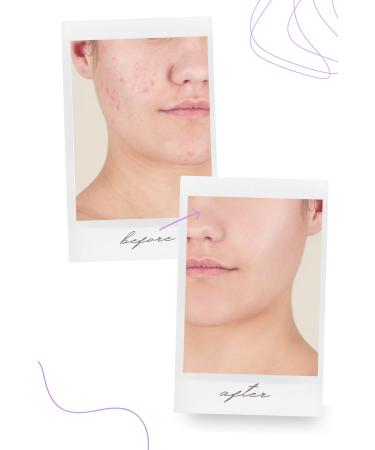 THEMUSTCARE Purifying and Brightening Enzyme Peeling Powder Cleanser 85 gr - Buy Online on GoSupps.com