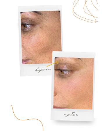 THEMUSTCARE Brightening Anti-Spot and Skin Tone Equalizing Ascorbic Acid Vitamin C Care Serum 30 ml - Buy Online on GoSupps.com