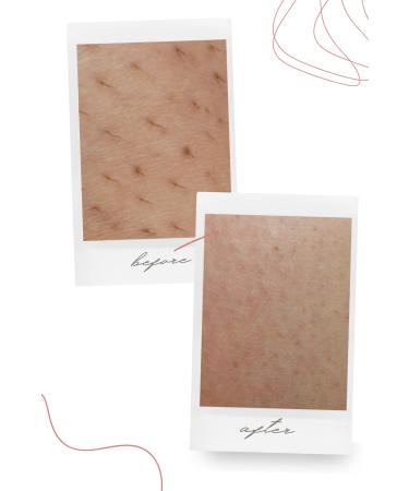 THEMUSTCARE Nettle & Hyaluronic Acid Essence Hair Thinning and Moisturizing Care Milk 50 ml - Buy Online on GoSupps.com