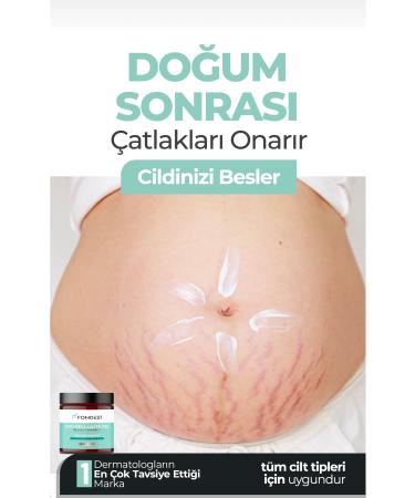 FONDEST Slimming1 'firming Cellulite and Stretch Mark Eliminating Body Shaping Gel 250 ml