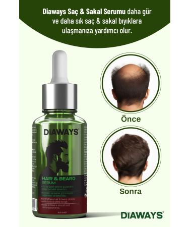 DIAWAYS Hair and Beard Serum Hair and Beard Mustache Growth Thickening Solution 100ml - Buy Online on GoSupps.com