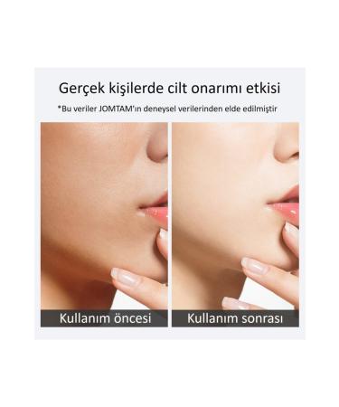 Jomtam Moisturizing Anti-Age Hyaluronic Acid Serum Ampoule 5 Ml - Buy Online on GoSupps.com