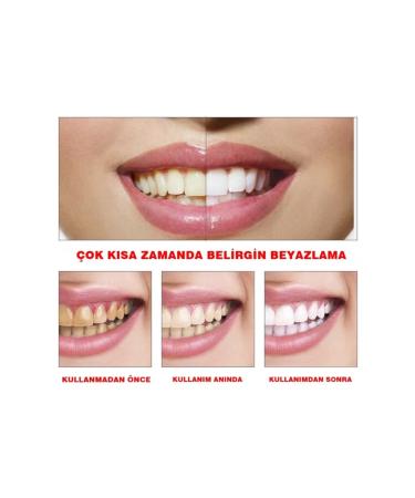 Teeth Cleaning Tartar Jaundice - Buy Online on GoSupps.com