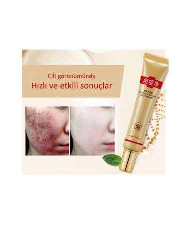 OneSpring Tea Tree Care Cream for Acne Prone Skin 30 Gr - Buy Online on GoSupps.com