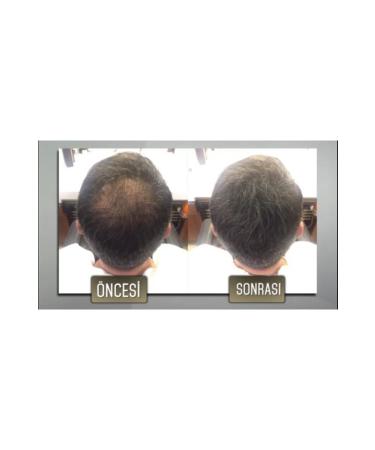 Jaja Hair Fiber Powder Keratin Black 50 gr X 3 Pcs - Buy Online on GoSupps.com