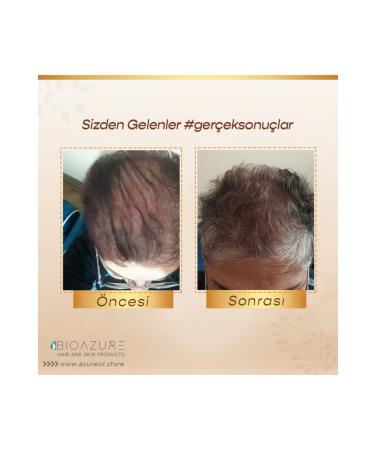 BIOAZURE Hair & Skin Products 3 Course B oazure Hair Care Serum - Buy Online on GoSupps.com