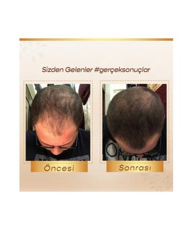 BIOAZURE Hair & Skin Products 3 Course B oazure Hair Care Serum - Buy Online on GoSupps.com