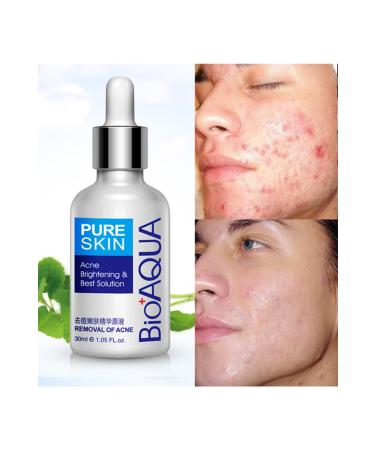 BIOAQUA Pure Skin Acne Prone Skin Care Serum 30 ml - Buy Online on GoSupps.com