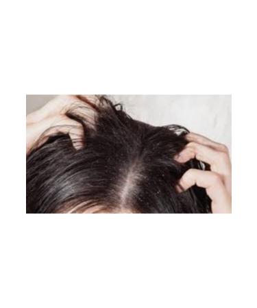 PROX VE Anti Hair Loss Salt-Free Olive Oil Shampoo 650 ml 2-pack - Buy Online on GoSupps.com