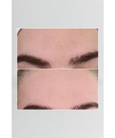 Pepplus + Super Lifting - Face Lifting and Tightening Set of 8 - Buy Online on GoSupps.com