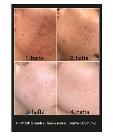 Derma clinic Niacinamide 12% + Zinc 1% Serum - Buy Online on GoSupps.com