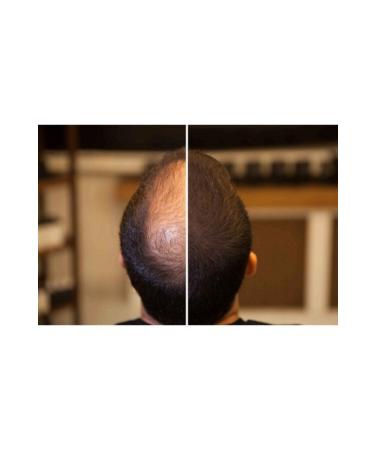 FIXPLANT 1 Bottle 28 gr Hair Thickening Powder - Dark Brown - Buy Online on GoSupps.com