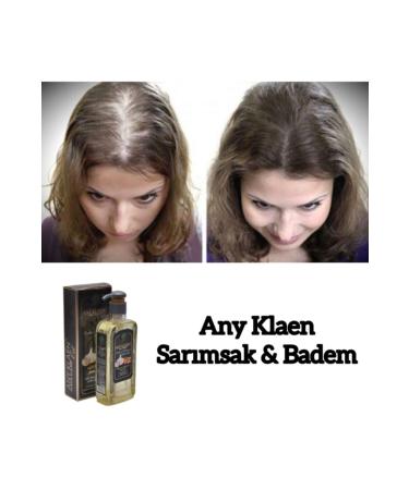 Any Klaen Hair Oil- Almond and Garlic Extract