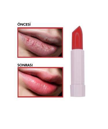 MT Strawberry Essence Lip Moisturizer 5g - Buy Online on GoSupps.com