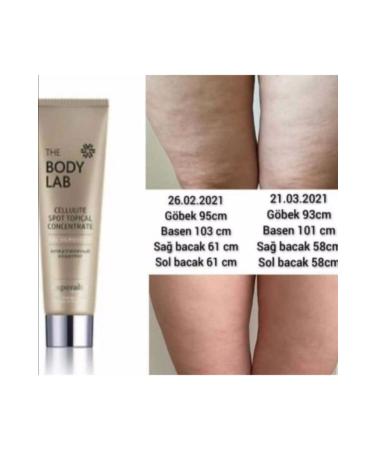 Body The Lab Cellulite Spot Topical Concentrate/cellulite and stretch marks cream/siberian wellness - Buy Online on GoSupps.com