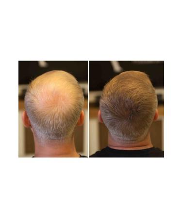 FIXPLANT 28 gr Dark Brown Hair Powder  - Buy Online on GoSupps.com