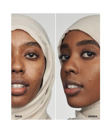 Clinique Even Better Clinical Serum Foundation Spf 20 192333078136 85169 Cn 116 Spice (d) - Buy Online on GoSupps.com