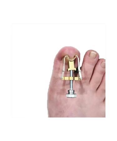 Ingrown Nail Removal Tool