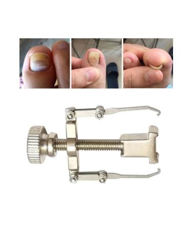 Ingrown Nail Removal Tool - Buy Online on GoSupps.com