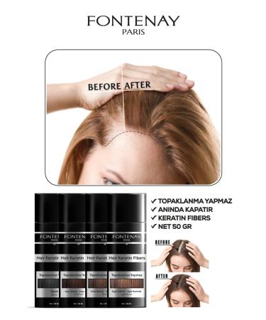 Fontenay Hair Volumizing Keratin Fibers Dark Brown Topical Hair Powder 50gr - Buy Online on GoSupps.com