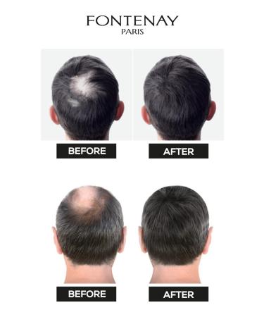 Fontenay Hair Volumizing Keratin Fibers Dark Brown Topical Hair Powder 50gr - Buy Online on GoSupps.com