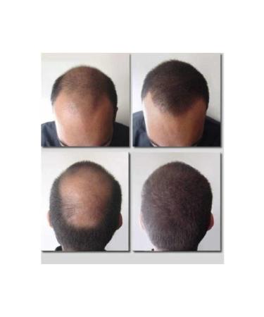 FIXPLANT 28 gr Hair Hair Fiber - Thickener - Hair Powder - Black - Buy Online on GoSupps.com