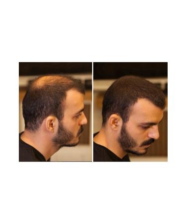 FIXPLANT 2 Bottles 56 gr Black Hair Thickening Powder - Buy Online on GoSupps.com