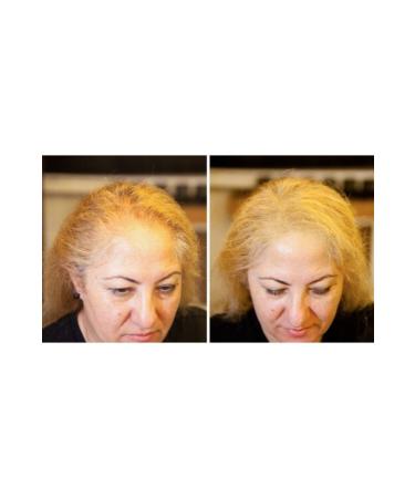 FIXPLANT 1 Bottle 28 gr Hair Powder Fiber - Medium Brown - Buy Online on GoSupps.com