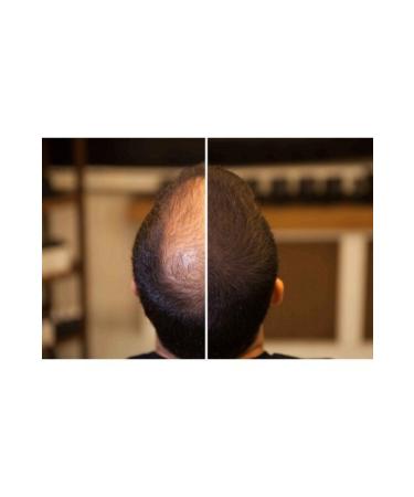 FIXPLANT 1 Bottle 28 gr Hair Powder Fiber - Medium Brown - Buy Online on GoSupps.com