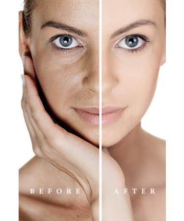 Pureexen Cosmetics Laboratory Eyeconic Collagen Anti-Wrinkle Eye Contour Cream for All Skin Types - Buy Online on GoSupps.com