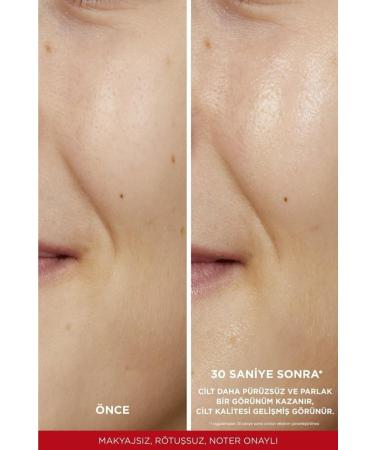 L'Oreal Paris Loreall Paris Revitalift %5 Pure Glycolic Acid Peeling Toner 180ml - Buy Online on GoSupps.com