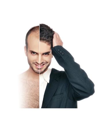 Priorin Original Bayer Intensive 120 Capsules - Buy Online on GoSupps.com