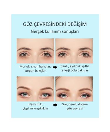 Jomtam Honey Royal Jelly and Propolis Ultra Rich Repairing Eye Cream 20 Gr - Buy Online on GoSupps.com